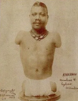 Görsel: Unknown authorUnknown author / Kamu malı Prince Randian